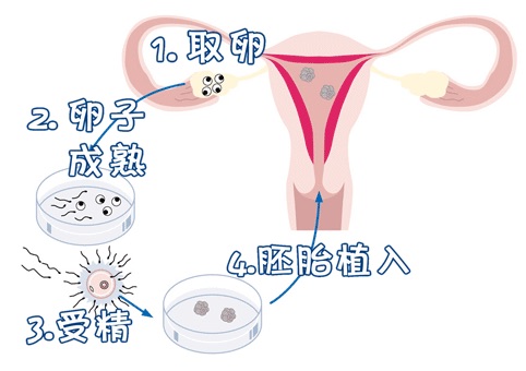 液氮储存